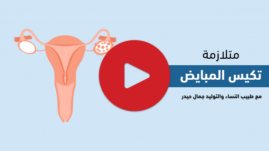 متلازمة تكيس المبايض