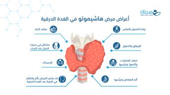 هاشيموتو