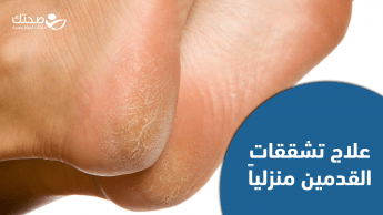 علاج تشققات القدمين منزليا