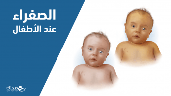 الصفراء عند الأطفال