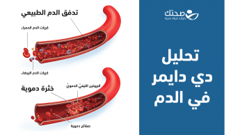 تحليل دي دايمر في الدم وكيفية فهم النتائج