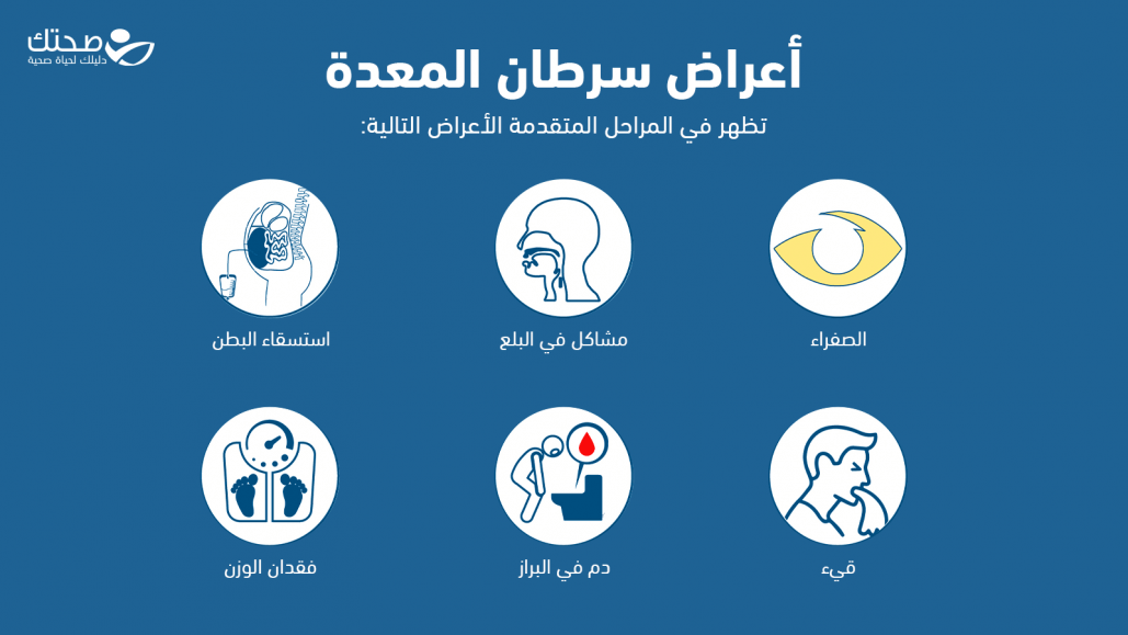 أعراض سرطان المعدة المتقدمة